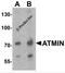 ATM Interactor antibody, 7777, ProSci, Western Blot image 