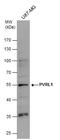 Nectin Cell Adhesion Molecule 1 antibody, GTX130824, GeneTex, Western Blot image 