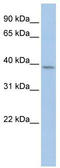 Cyclin Y antibody, TA342535, Origene, Western Blot image 