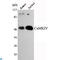 Calcium/Calmodulin Dependent Protein Kinase IV antibody, LS-C812900, Lifespan Biosciences, Western Blot image 