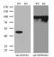 Mitogen-Activated Protein Kinase Kinase 1 antibody, GTX84167, GeneTex, Western Blot image 