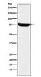 TRNA Methyltransferase 2 Homolog A antibody, M13996-1, Boster Biological Technology, Western Blot image 