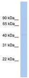 Eukaryotic Translation Initiation Factor 4A3 antibody, TA341591, Origene, Western Blot image 