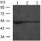 Gamma-Aminobutyric Acid Type A Receptor Alpha3 Subunit antibody, TA323565, Origene, Western Blot image 