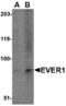 Transmembrane Channel Like 6 antibody, LS-B2699, Lifespan Biosciences, Western Blot image 