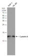 Cystatin A antibody, GTX130885, GeneTex, Western Blot image 