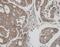 Thioredoxin Reductase 1 antibody, GTX103202, GeneTex, Immunohistochemistry paraffin image 