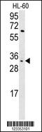 Killer Cell Immunoglobulin Like Receptor, Two Ig Domains And Short Cytoplasmic Tail 3 antibody, PA5-25667, Invitrogen Antibodies, Western Blot image 