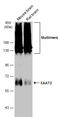 Solute Carrier Family 1 Member 2 antibody, GTX134062, GeneTex, Western Blot image 