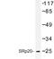 Serine And Arginine Rich Splicing Factor 3 antibody, LS-B11073, Lifespan Biosciences, Western Blot image 