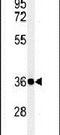 Fc Fragment Of IgG Receptor Ia antibody, PA5-24855, Invitrogen Antibodies, Western Blot image 