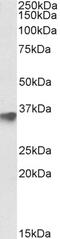 Nucleolar And Coiled-Body Phosphoprotein 1 antibody, 43-434, ProSci, Enzyme Linked Immunosorbent Assay image 