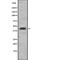 DnaJ Heat Shock Protein Family (Hsp40) Member A1 antibody, abx149886, Abbexa, Western Blot image 