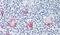 TOR antibody, PA5-34166, Invitrogen Antibodies, Immunohistochemistry paraffin image 