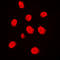 Mitogen-Activated Protein Kinase Kinase Kinase 3 antibody, LS-C354035, Lifespan Biosciences, Immunofluorescence image 