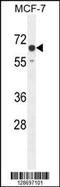 Transmembrane Protein 266 antibody, MBS9202004, MyBioSource, Western Blot image 