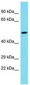 Phospholipase D Family Member 5 antibody, TA331622, Origene, Western Blot image 