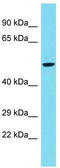 Inactive phosphatidylcholine-hydrolyzing phospholipase D5 antibody, TA331622, Origene, Western Blot image 