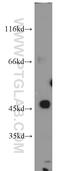 Transmembrane Protein With EGF Like And Two Follistatin Like Domains 2 antibody, 11928-1-AP, Proteintech Group, Western Blot image 