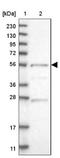 Adenylate Kinase 8 antibody, NBP1-88243, Novus Biologicals, Western Blot image 