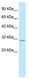 Potassium Voltage-Gated Channel Interacting Protein 4 antibody, TA337256, Origene, Western Blot image 