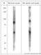 Two Pore Segment Channel 1 antibody, LS-C95183, Lifespan Biosciences, Western Blot image 