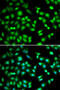 Cyclin Dependent Kinase Inhibitor 2D antibody, abx005030, Abbexa, Western Blot image 