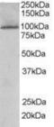 TAO Kinase 3 antibody, NB300-815, Novus Biologicals, Western Blot image 