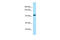 Taste 1 Receptor Member 2 antibody, ARP65281_P050, Aviva Systems Biology, Western Blot image 