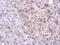Tetratricopeptide Repeat Domain 39B antibody, NBP2-15148, Novus Biologicals, Immunohistochemistry frozen image 