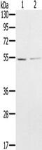 N-Myristoyltransferase 2 antibody, TA350232, Origene, Western Blot image 