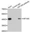 Hypoxia Inducible Factor 1 Subunit Alpha Inhibitor antibody, LS-C334077, Lifespan Biosciences, Immunoprecipitation image 