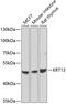 Keratin 13 antibody, GTX33138, GeneTex, Western Blot image 