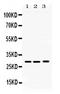 Proteasome Subunit Alpha 3 antibody, PB10089, Boster Biological Technology, Western Blot image 