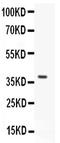 GDNF Family Receptor Alpha 1 antibody, PB9202, Boster Biological Technology, Western Blot image 