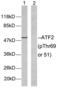 Activating Transcription Factor 2 antibody, LS-C117296, Lifespan Biosciences, Western Blot image 