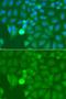 Interleukin 1 Receptor Associated Kinase 2 antibody, LS-C348975, Lifespan Biosciences, Immunofluorescence image 