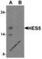 Transcription factor HES-5 antibody, 8055, ProSci, Western Blot image 