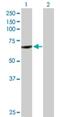 Cytochrome P450 Family 11 Subfamily B Member 1 antibody, H00001584-D01P, Novus Biologicals, Western Blot image 