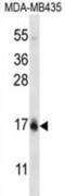 Histone Cluster 1 H2B Family Member I antibody, abx027051, Abbexa, Western Blot image 
