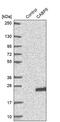 Calcium Binding Protein 5 antibody, PA5-60470, Invitrogen Antibodies, Western Blot image 
