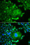 Calcium Voltage-Gated Channel Auxiliary Subunit Gamma 4 antibody, 15-380, ProSci, Immunofluorescence image 