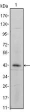 Integrin Subunit Alpha 5 antibody, NBP2-37666, Novus Biologicals, Western Blot image 