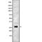 Transmembrane Protein 106C antibody, PA5-67816, Invitrogen Antibodies, Western Blot image 