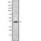 Homeobox D13 antibody, abx216021, Abbexa, Western Blot image 