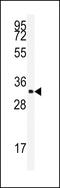 Serine And Arginine Rich Splicing Factor 2 antibody, GTX82501, GeneTex, Western Blot image 