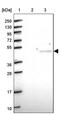 Cartilage Associated Protein antibody, PA5-60630, Invitrogen Antibodies, Western Blot image 