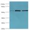 Aldehyde Dehydrogenase 1 Family Member B1 antibody, MBS1495829, MyBioSource, Western Blot image 