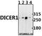 Dicer 1, Ribonuclease III antibody, A00190, Boster Biological Technology, Western Blot image 