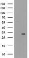 Nicotinamide Nucleotide Adenylyltransferase 1 antibody, M03221, Boster Biological Technology, Western Blot image 
